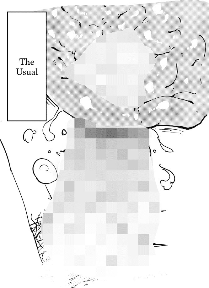 The Weeny Corrections Manual